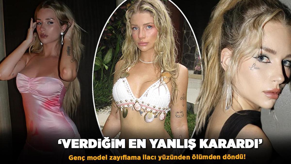 Kate Moss’un Üvey Kardeşi Lottie Moss Zayıflama İlacı Yüzünden Hastanelik Oldu