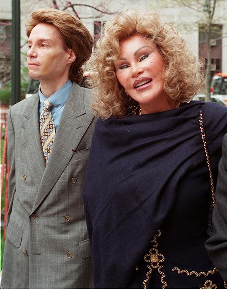 Jocelyn Wildenstein: Kedi Kadın ve Estetik Operasyonları