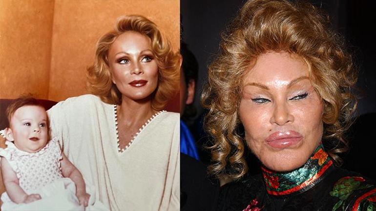 Jocelyn Wildenstein: Kedi Kadın ve Estetik Operasyonları