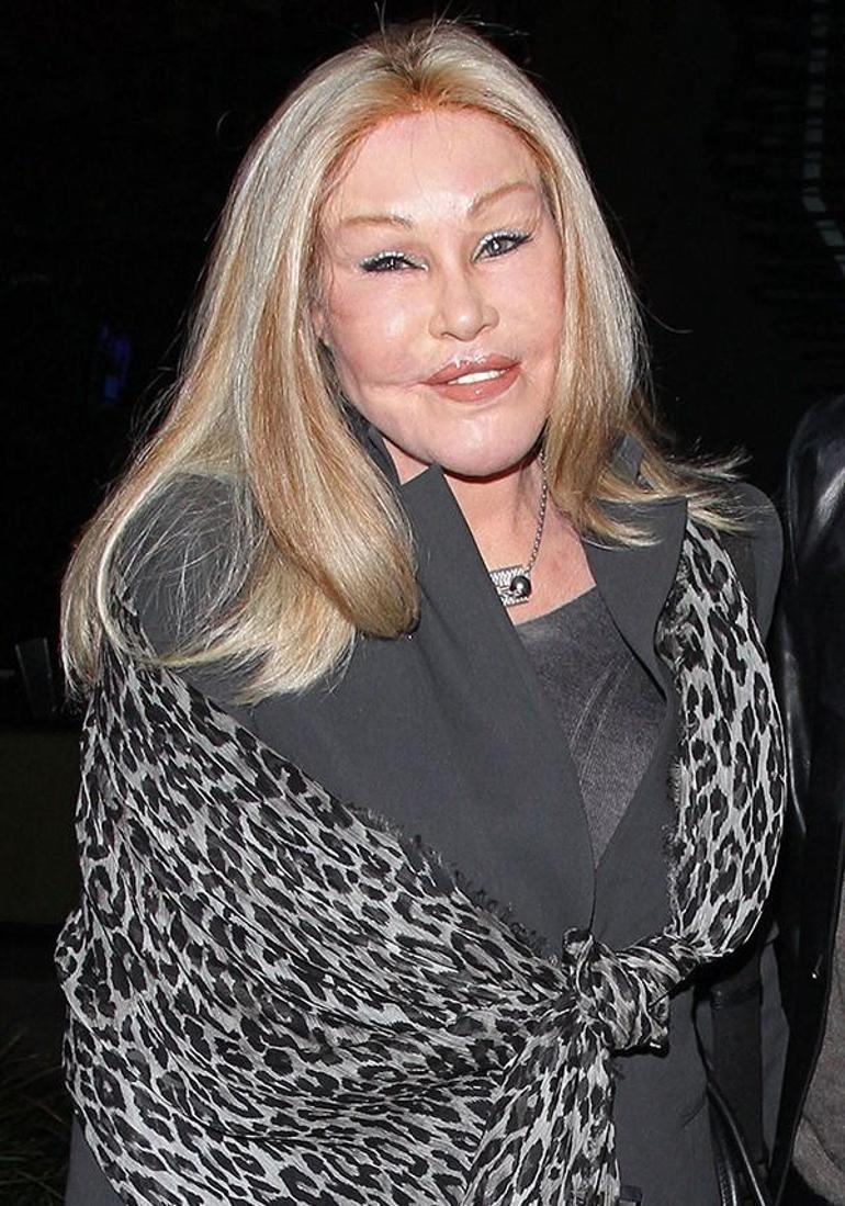 Jocelyn Wildenstein: Kedi Kadın ve Estetik Operasyonları