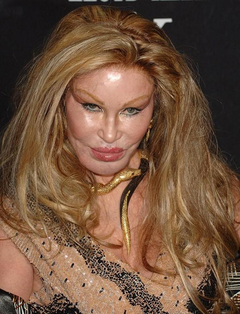 Jocelyn Wildenstein: Kedi Kadın ve Estetik Operasyonları