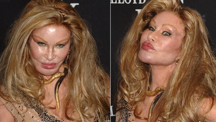 Jocelyn Wildenstein: Kedi Kadın ve Estetik Operasyonları