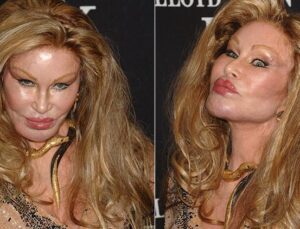 Jocelyn Wildenstein: Kedi Kadın ve Estetik Operasyonların Gizemi