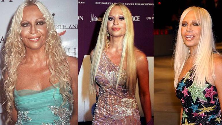 Donatella Versace'nin Şaşırtan Görünümü ve Estetik Tartışmaları