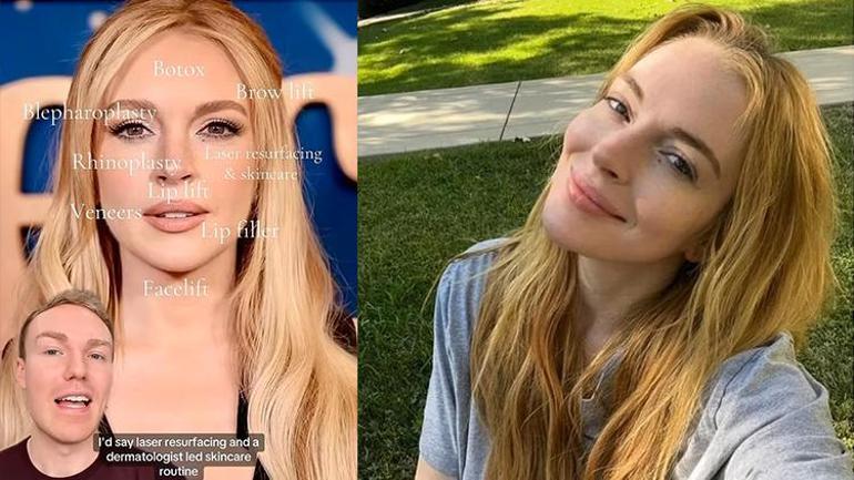 Lindsay Lohan'ın Yeniden Doğuşu: Estetik Değişim ve Yeni Hayatı